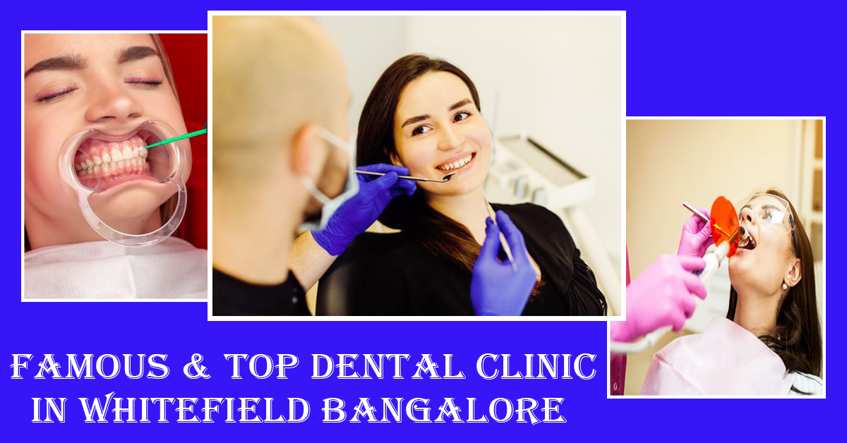 Best Dentist in Whitefield Bangalore | Famous & Top Dental