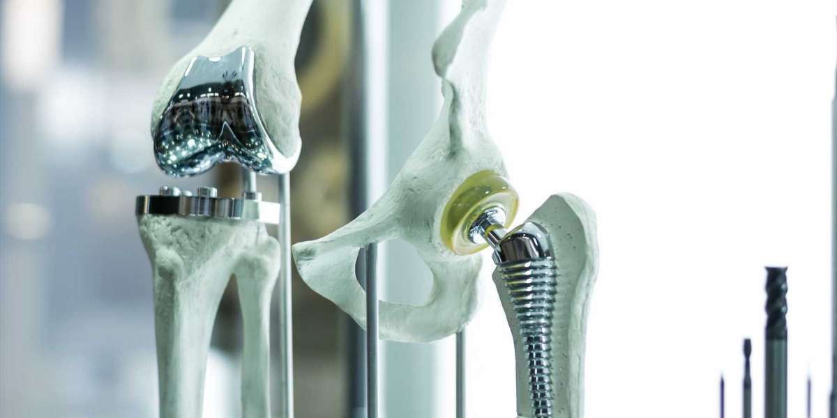 Research report on America Orthopedic Biomaterial Market Share with Industry Size & Future Growth