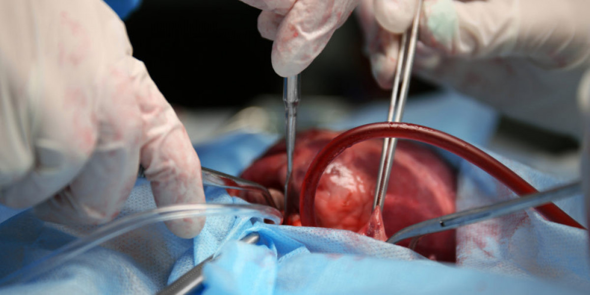 Organ Transplantation Market Overview Analysis Drivers, Trends and Forecast to 2032