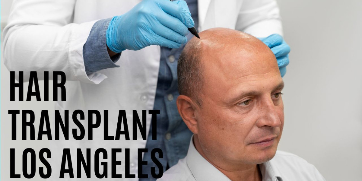 Unveiling the Process of Hair Transplant Los Angeles
