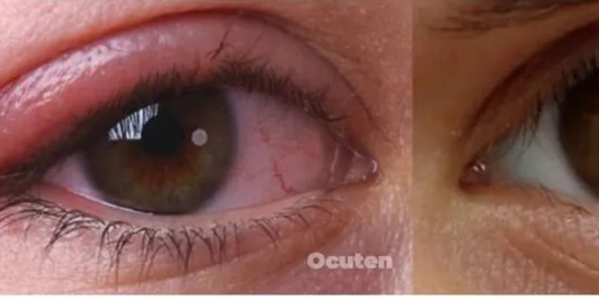 Ocutene - Capsula original, suplemento que cuida la salud ocular