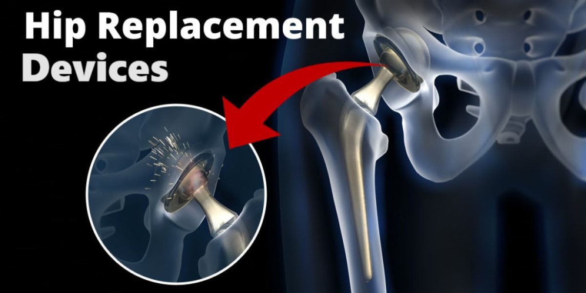 Hip Reconstruction Devices Market Size, In-depth Analysis Report and Global Forecast to 2032