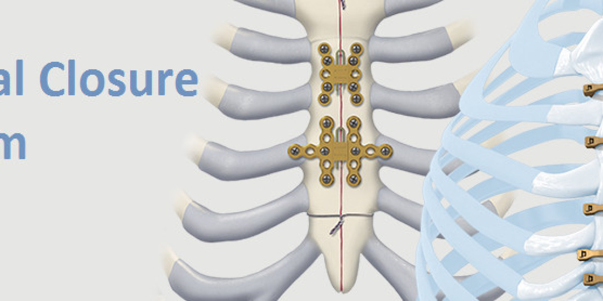 Sternal Closure Systems Market 2023 Size, Growth Factors & Forecast Report to 2032