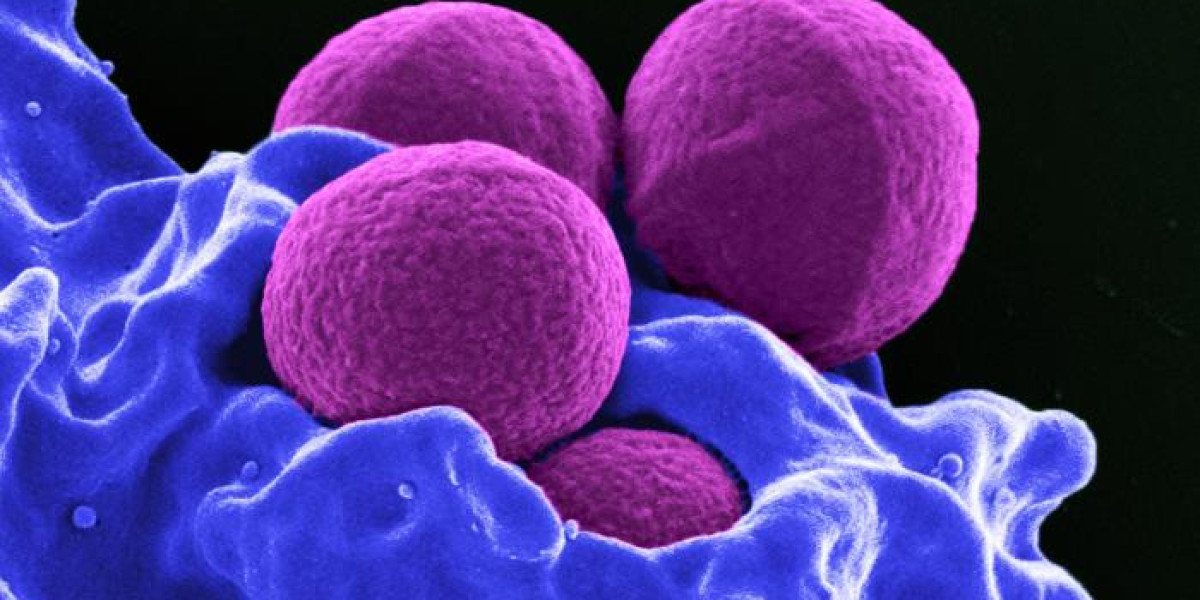 Microencapsulation Market Research Report: Global Industry Overview to 2032