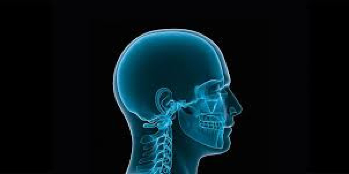 Craniomaxillofacial (CMF) Devices/System Market Size, Share, Regional Overview and Global Forecast to 2032