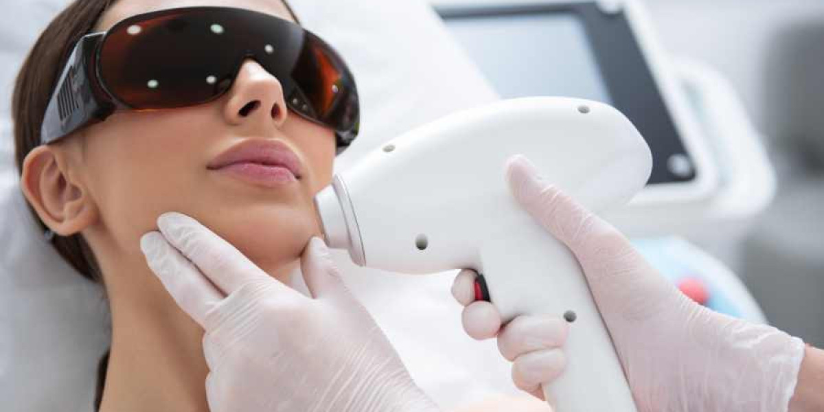 Laser Hair Removal Market 2023 Global Industry Analysis With Forecast To 2032