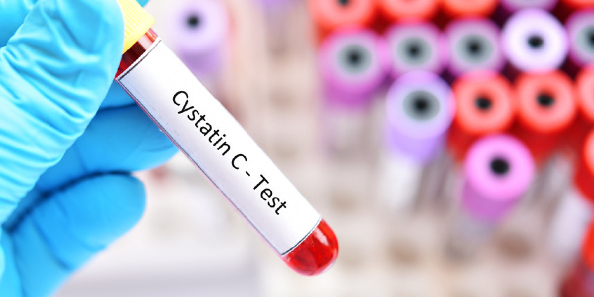 Global Cystatin C Assay Market Growth, Analysis and Forecast 2023 - 2033