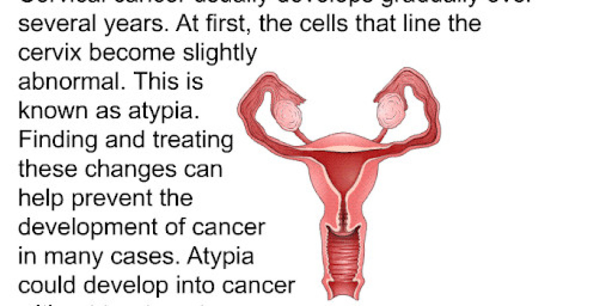 Cervical Cancer Treatment Market Size, Dynamics & Forecast Report to 2032