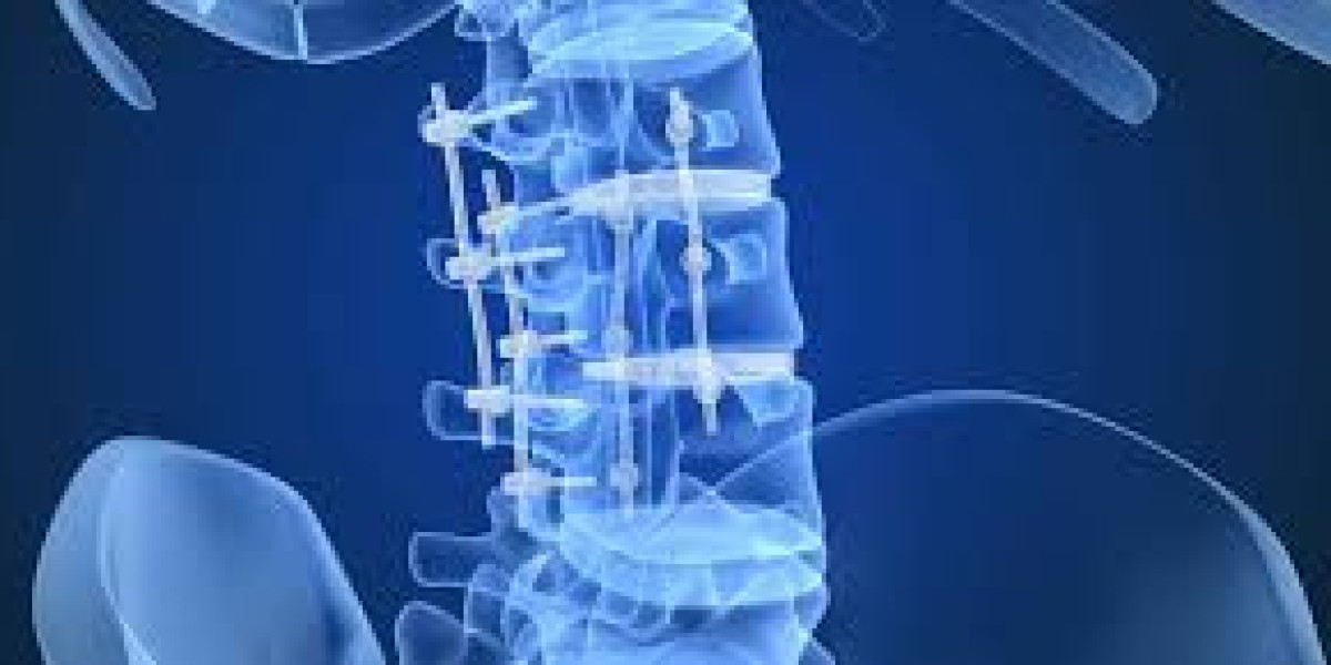 Global Spinal Implants and Devices Market Size, Share, Forecast 2022 – 2032