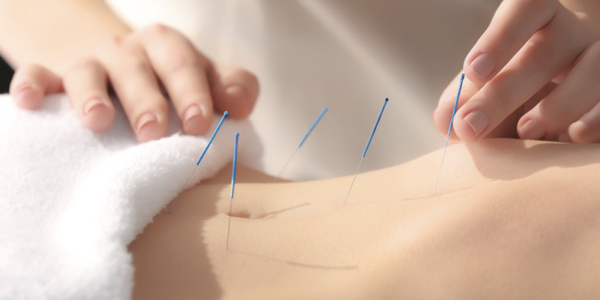 Acupuncture for Fertility Support: A Holistic Approach to Enhancing Reproductive Health