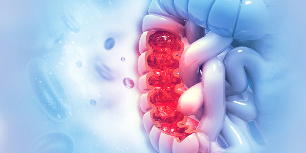 Colorectal Cancer Therapeutic Market Size, Growth & Industry Analysis Report, 2023-2032