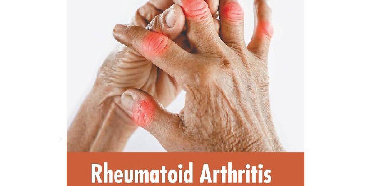 Rheumatoid Arthritis Market Players Expand Portfolios with Next-Gen Therapeutics