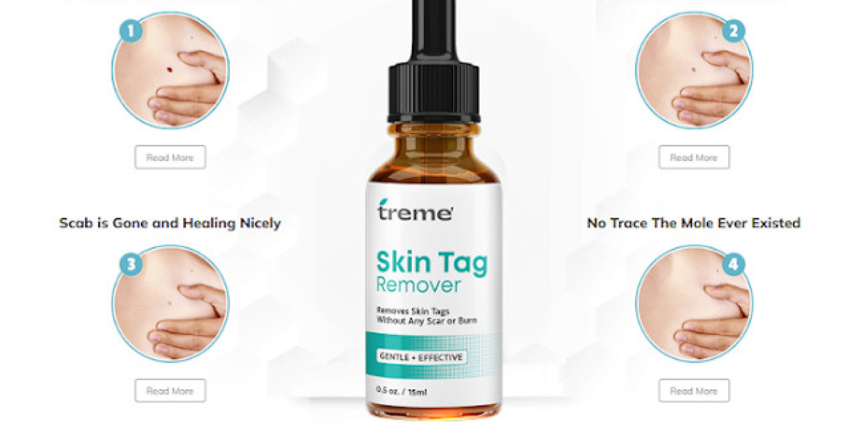 Which Major Ingredients Actually Work in Treme SkinTags, Moles & Wart Remover?