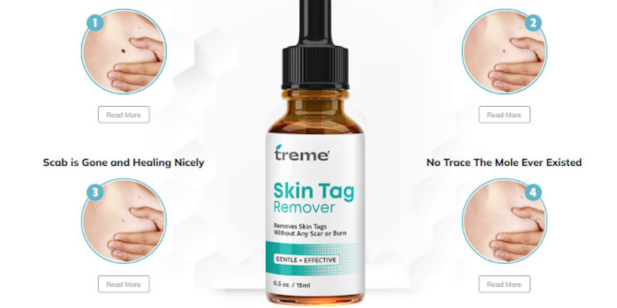 What is Treme Tag Remover: used for Safe? {Official Website}