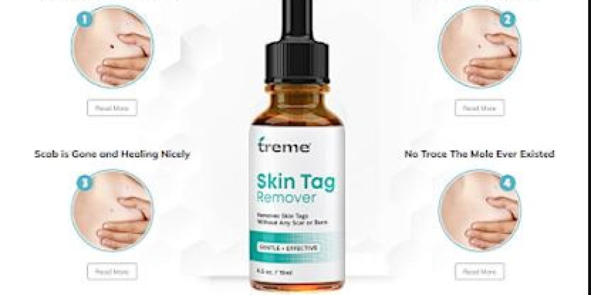 Treme Skin Tag Removal Serum: What Makes This Supplement Powerful?