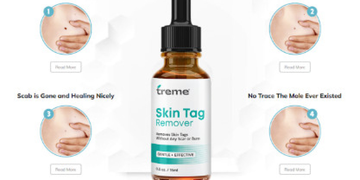 Why Treme SkinTag Remover Is So Popular Skin Tag Remover?