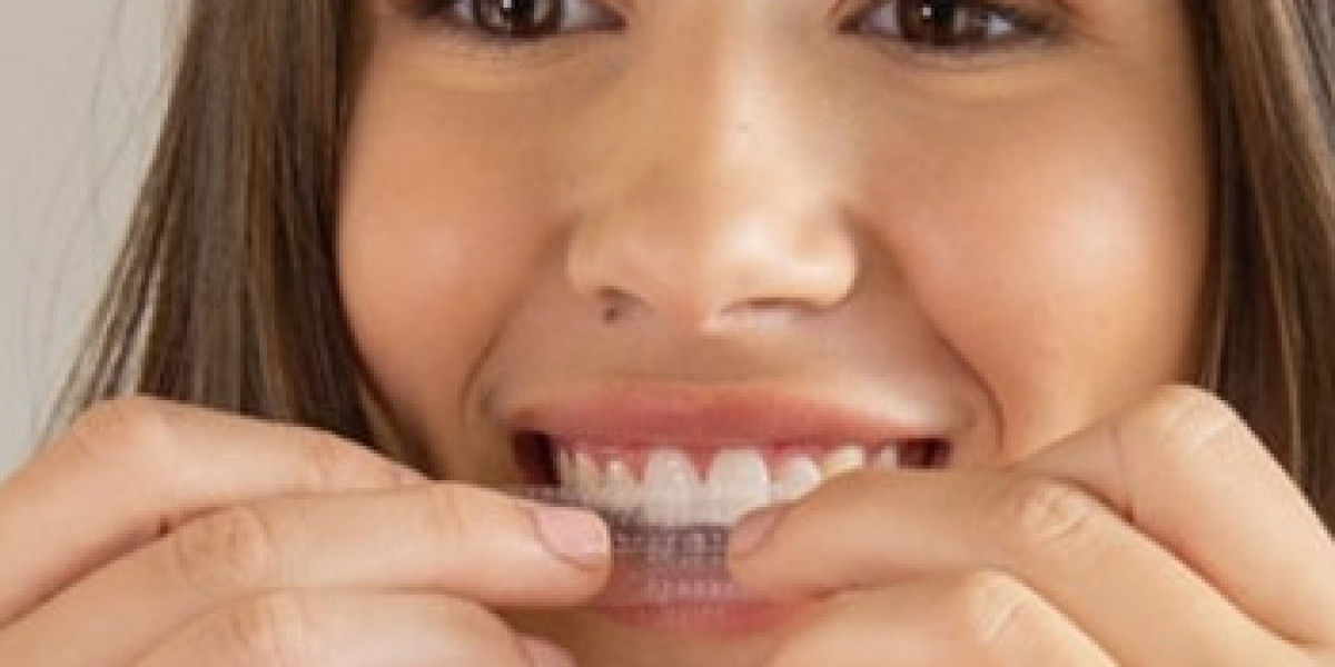 How to Choose the Best Teeth Whitening Strips: A Comprehensive Review