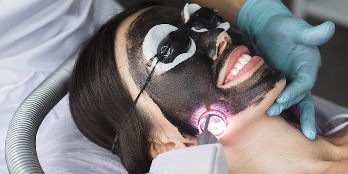 Laser Carbon Peel in Dubai: The Ultimate Skin Rejuvenation Treatment