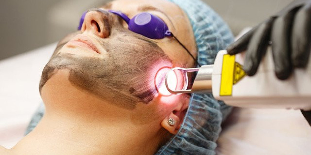 Melasma Treatment in Dubai: A Comprehensive Guide to Restoring Clear Skin