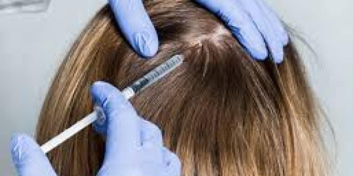 Exosome Therapy for Hair Loss: A Revolutionary Treatment for Hair Regrowth