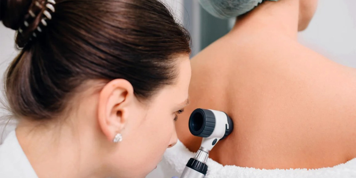Finding the Best Dermatologist Delray Beach for Healthy Skin