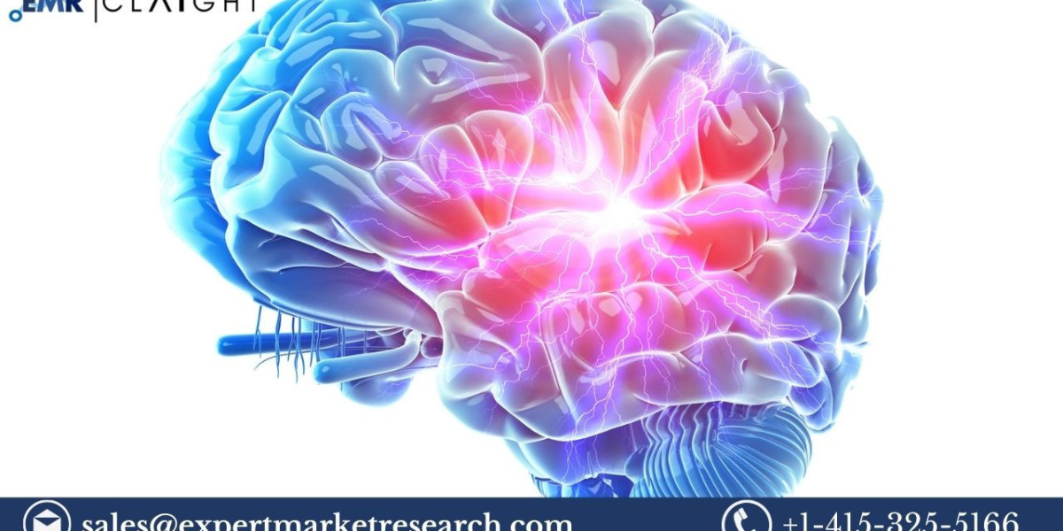 North America Intracranial Aneurysm Market: Growth, Trends, and Forecasts (2025-2034)