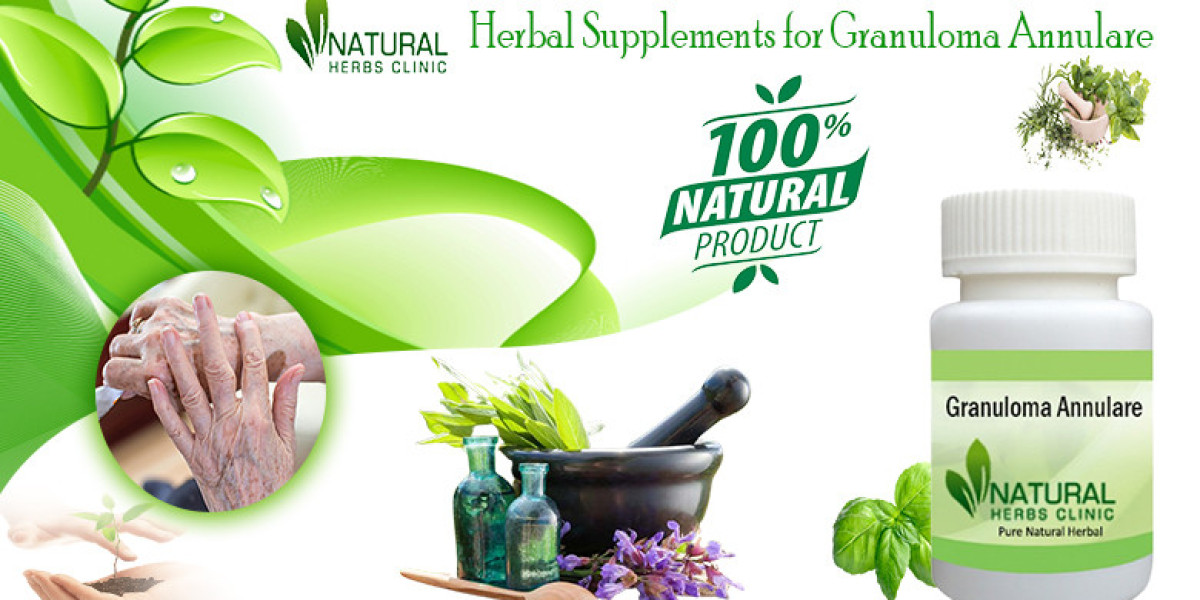 Herbal Supplement for Granuloma Annulare