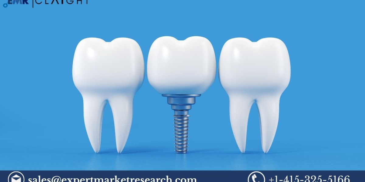 Dental Implants Market: Growth, Trends, and Key Insights (2025-2034)