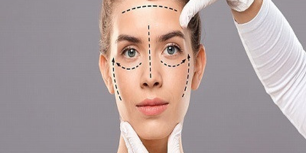 What happens during a facelift surgery?