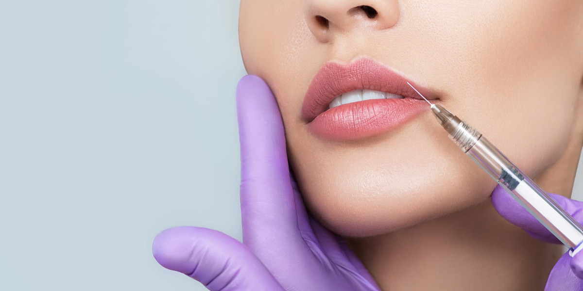 Real Before and After Cases of Dermal Fillers in Islamabad