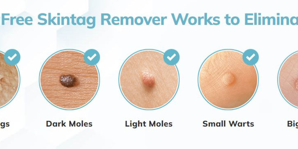 https://tagfree-skin-tag-remover.alboompro.com/