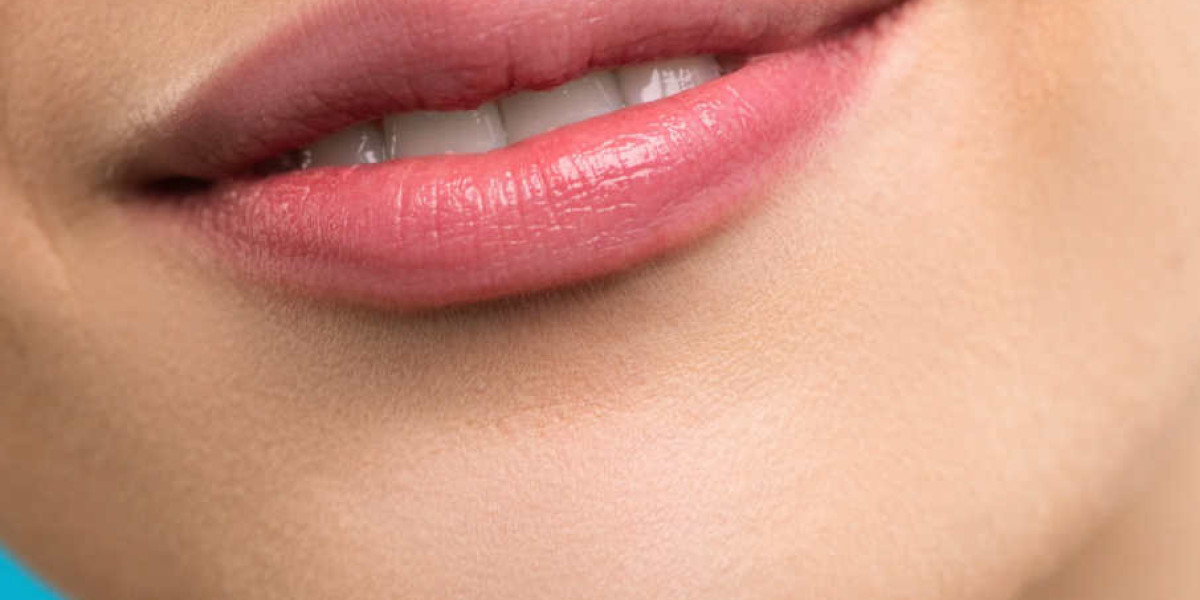 What Is Lip Augmentation? Complete Guide for Beginners in Islamabad