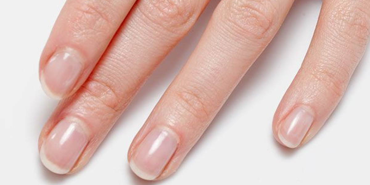 Lumonail: Ihr starker Verbündeter gegen hartnäckigen Nagelpilz