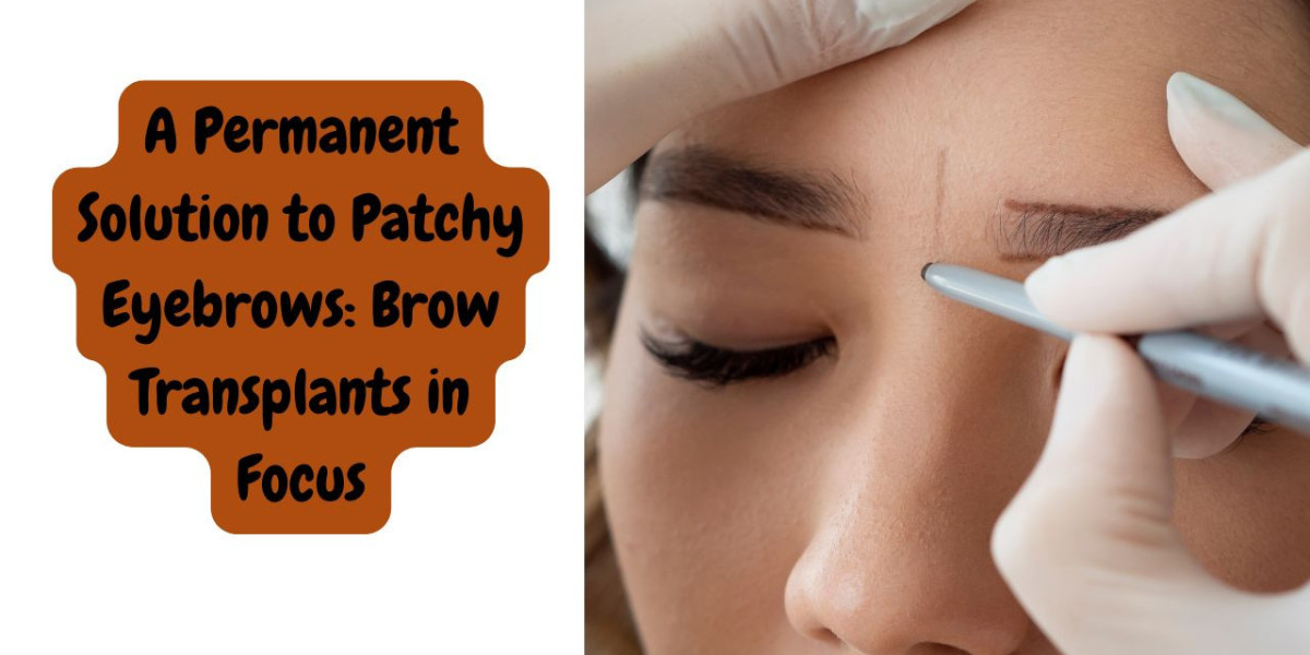 A Permanent Solution to Patchy Eyebrows: Brow Transplants in Focus