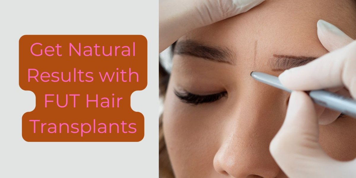 Get Natural Results with FUT Hair Transplants