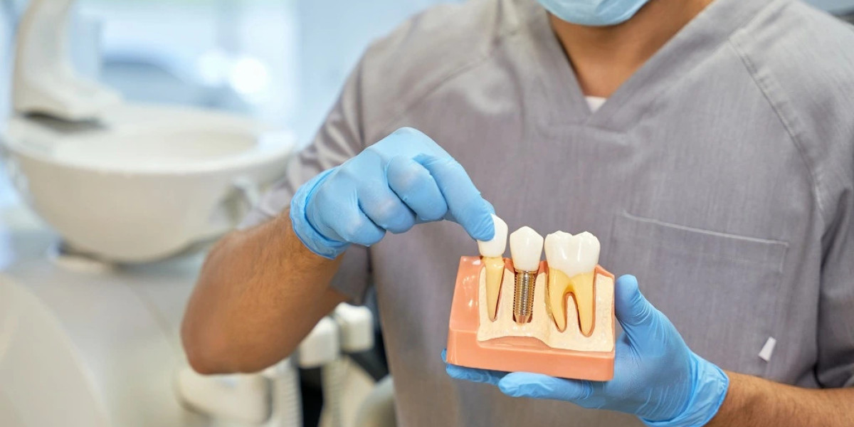 Look Recovery Built Straightforward using Dental Implants in Darwin