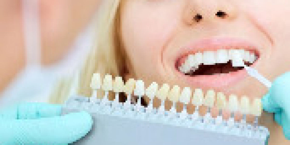Achieve Your Brightest Smile with Professional & Natural Teeth Whitening in Australia