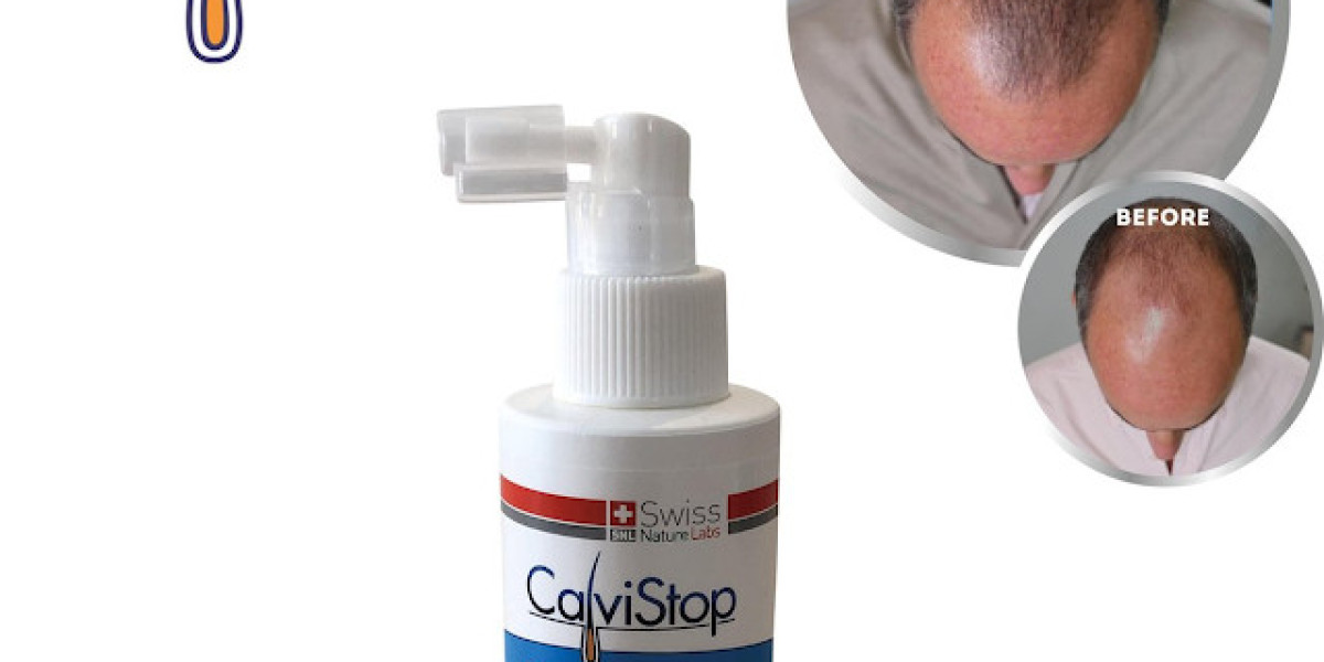 CalviStop™ Hair Loss Treatment in USA